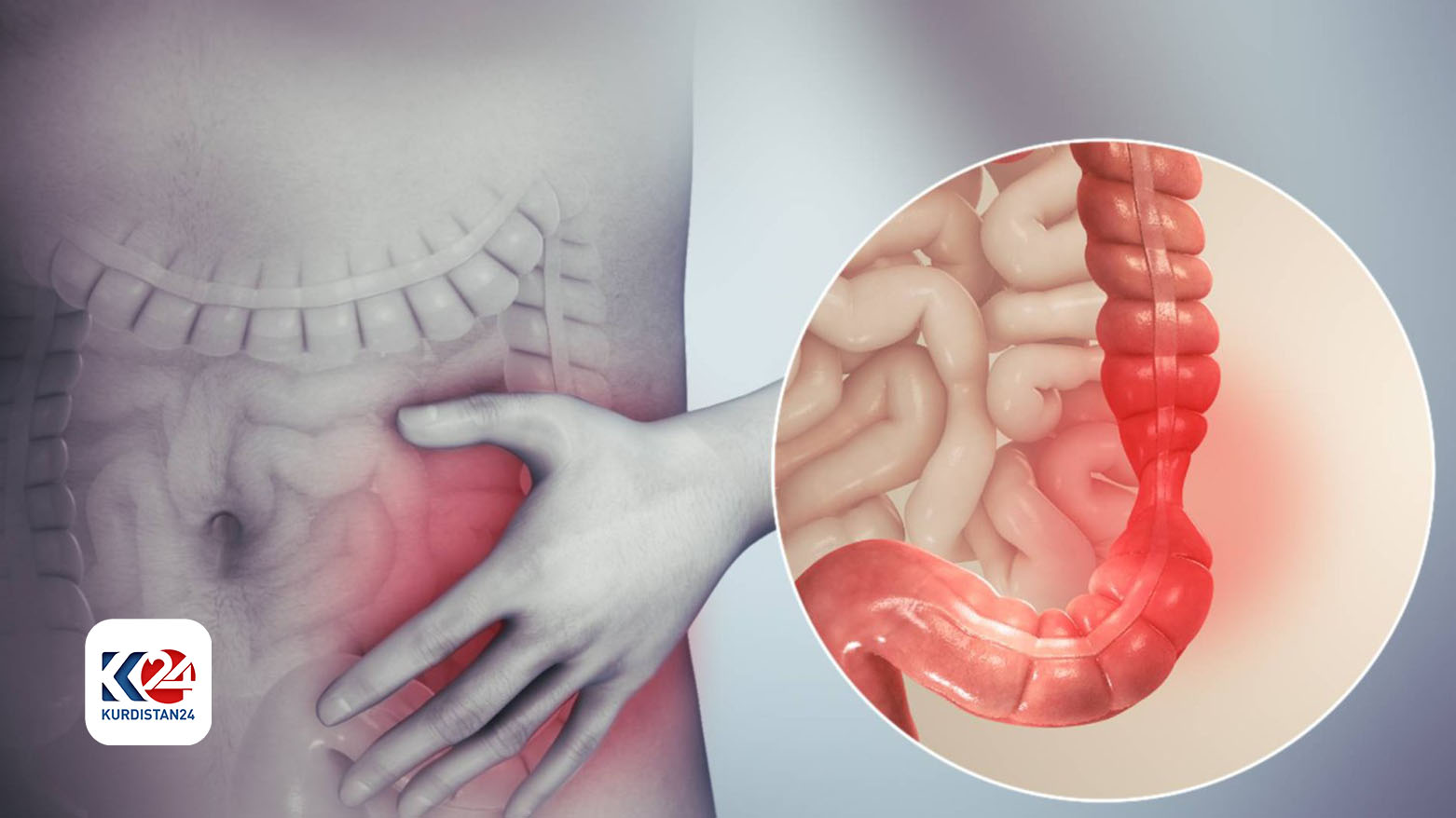 6 أطعمة تجعل قولونك العصبي في حالة أسوأ